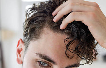 Hair Transplant Before and After: What to Expect Month by Month (Complete Guide)
