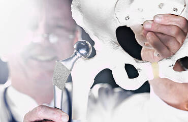 Partial vs Total Hip Replacement: Which Surgery Is Right for You?