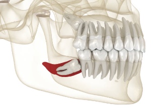 Everything You Need to Know About Wisdom Teeth