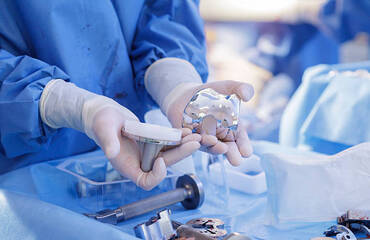 Knee Implants: A Simple Guide